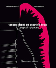 Tessuti molli ed estetica rosa in terapia implantare - Librerie.coop Tessuti molli ed estetica rosa in terapia implantare - Librerie.coop