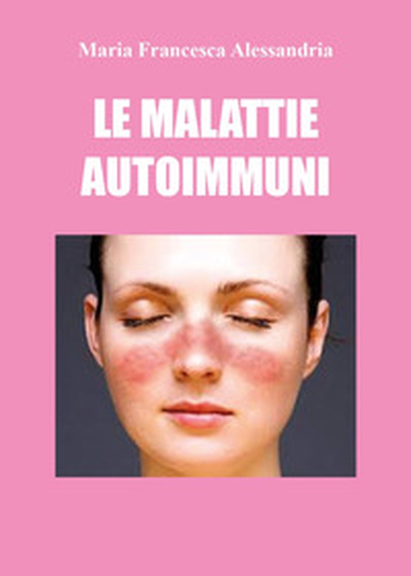 Le malattie autoimmuni - Librerie.coop Le malattie autoimmuni - Librerie.coop
