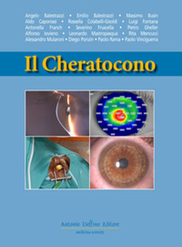 Il cheratocono - Librerie.coop Il cheratocono - Librerie.coop