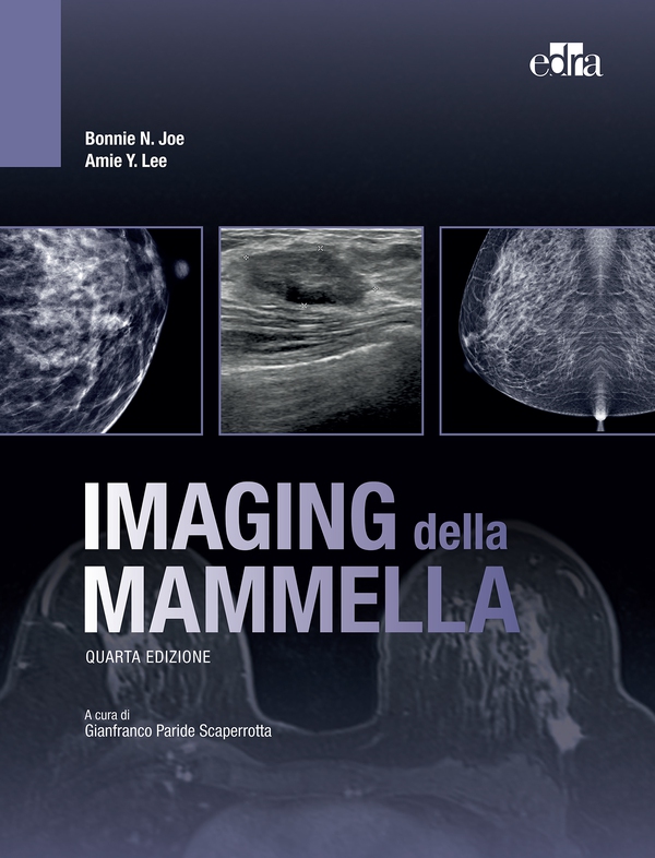 Imaging della mammella, 4 ed. - Librerie.coop Imaging della mammella, 4 ed. - Librerie.coop